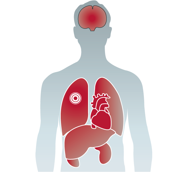 Physiology of sepsis - Sepsis Amsterdam